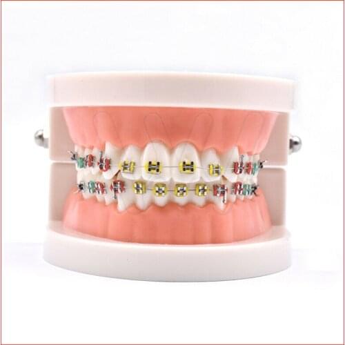 Dental Orthodontic Teeth Hoop Model Metal Brackets Ligature Tie Adult Standard