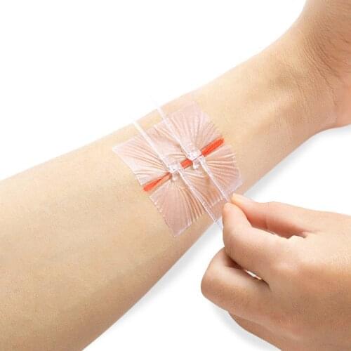 1pc Zipper Band-aid Painless Wound Closure Device Without Needles Suture-free Wound Dressing Patch Zip Suture Reducer Band Aid