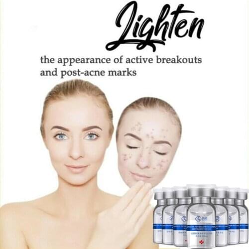 1 Set=5pair Lyophilized Powder+Plasmin Solution Face Serum Hyaluronic acid Shrink Pores Anti- Acne Oligopeptide Repair Cream