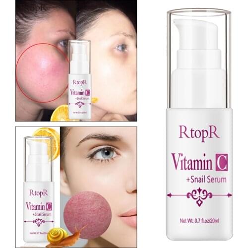 Wonder VC Snail Pure Essence Anti-aging Moisturizing Hyaluronic Fluid Face Ance Treatment Snail VC Collagen Repair Serum