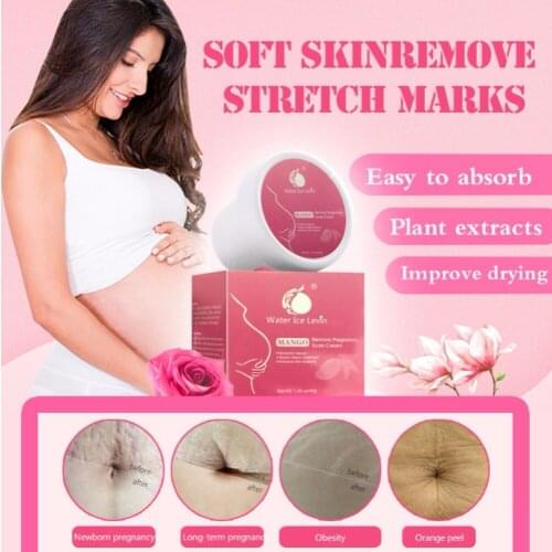 Body Cream Stretch Mark Cream Lighten Prevent Stretch Marks Postpartum Repair Cream Moisturizer Body Cream