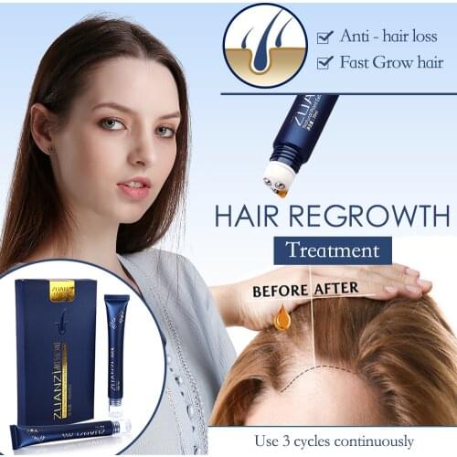 Hair Growth Essence Triple Roller Massager Anti hair loss Treatment Promote hair growth tools Hair Care Products 30ml×2