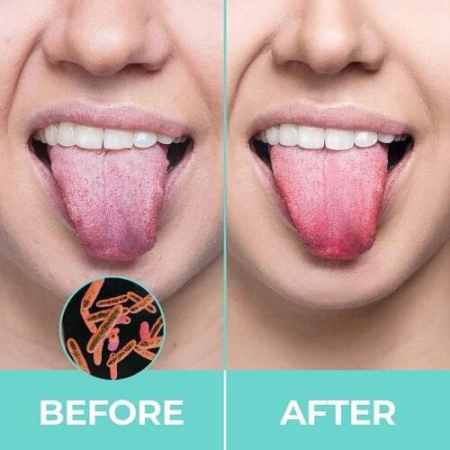 Tongue Scraper Cleaner Fresh Breath Cleaning Coated TongueToothbrush Tools Oral Care Hygiene P2X0