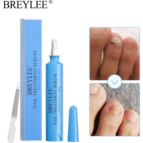 Yoxier Gel Nail Polish