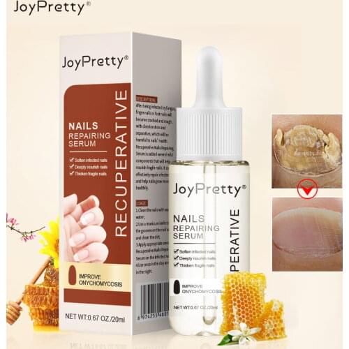 Auquest Nail Repair Serum Fungal Nail Removal Essence Improve Onychomycosis Paronychia Anti Infection Nail Fungal Treatment Care