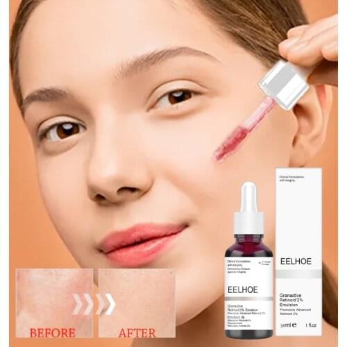 Salicylic Acid Serum Anti Acne Exfoliating Face Serum Peeling Solution Pore Shrinking Oil-Control Firming Skin Treatments TSLM1