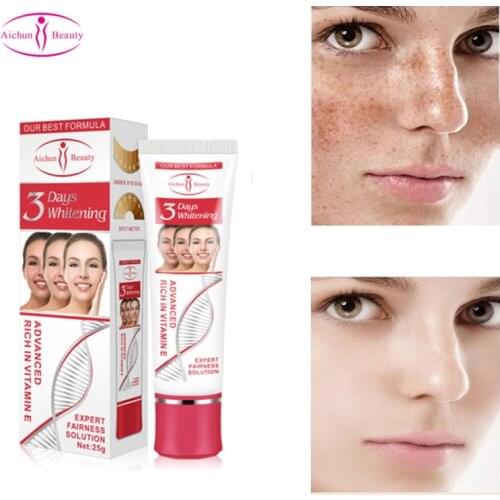 Fast Whitening Facial Cream Nicotinamide Freckle Removal Improve Dullness Pigment Melanin Remove Dark Spot Fast Whiten Skin Care