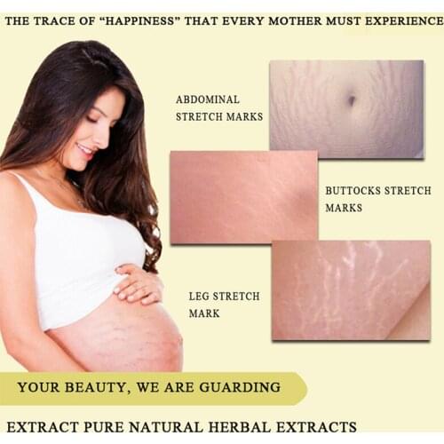 OEDO Remove Stretch Marks Cream Anti Wrinkle Anti Aging Maternity Skin Repair Remove Pregnancy Scars Treatment Body Skin Care