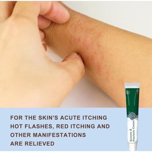 Fushiqing Xiyu Bawang Fushiqing Herbal Cream Xinjiang Antibacterial Cream and Antipruritic K8O4