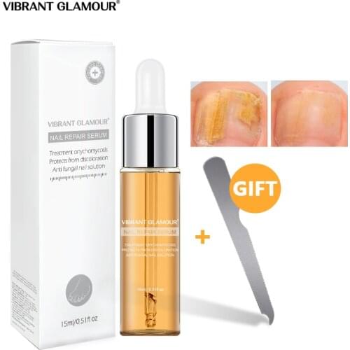 VIBRANT GLAMOUR Nail Repair Serum Nail Fungus Treatment Onychomycosis Nail Treatment Essence Anti Fungus Nail Toe Nail Care 15ml