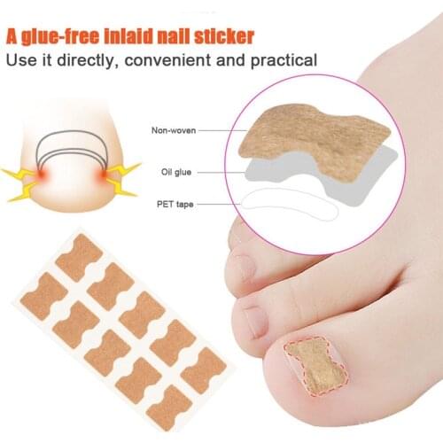 2/5Pcs Ingrown Toe Nail Corrector Parches Stickers Glue-free Correction Treatment Elastic Sticker Foot Care Tools