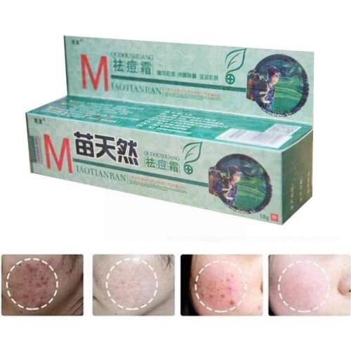 1pc original MiaoTian natural removal acne cream removes skin mites bactericidal and moisturizes acne lubricates J3E7