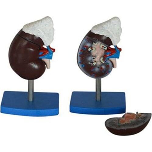 Renal anatomy and adrenal gland model