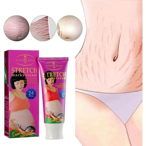 Stretch Marks Remover snails Skin Care Treatment Cream For Stretch Mark Removal Maternity Slackline For Pregnant Body Cream