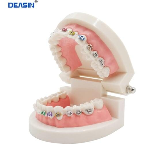 Dental Orthodontic Treatment Model With Ortho Metal Ceramic Bracket Arch Wire Buccal Tube Ligature Ties Dental Tools