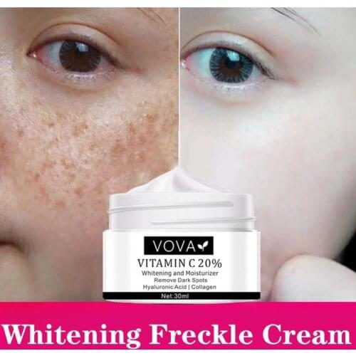 30ml Freckle Cream Vitamin C 20 Remove Dark Spots Portable C20 Whitening Freckle Spot Cream for Female Whitening Freckle Cream