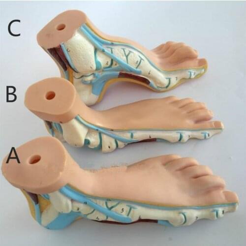 Human Foot Model Foot Muscles Flatfoot Talipes cavus Bow foot model Anatomical Anatomy Medical Science teaching model