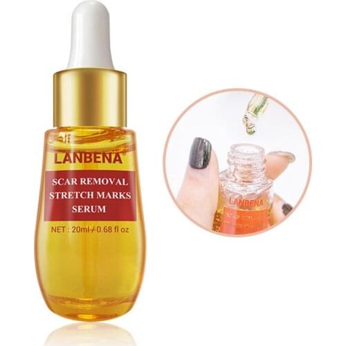 LANBENA Acne Essence Care Remove Stretch Mark Anti-Acne Shrinkage Pore Blackhead Repair Essence