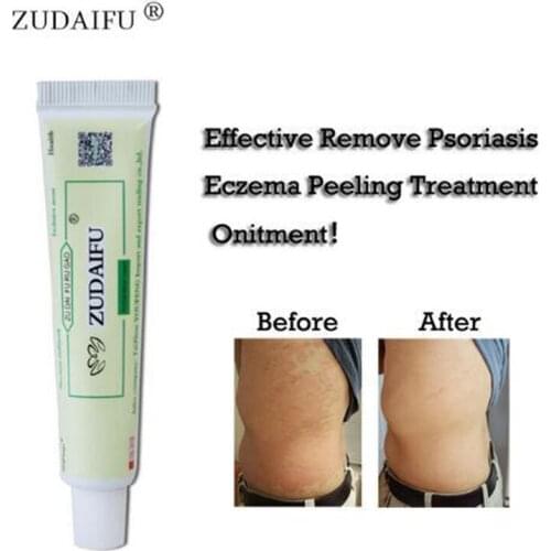 Zudaifu Psoriasis Cream Body Skin Care Dermatitis Eczematoid Eczema Ointment Sulfur Soap Skincare Cream 30g