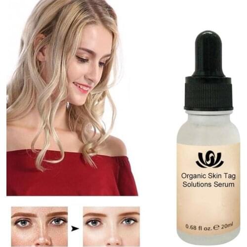 Organic Tags Solutions Serum Painless Mole Skin Dark Spot Removal Serum Face Wart Tag Freckle Removal Cream Oil Plaster