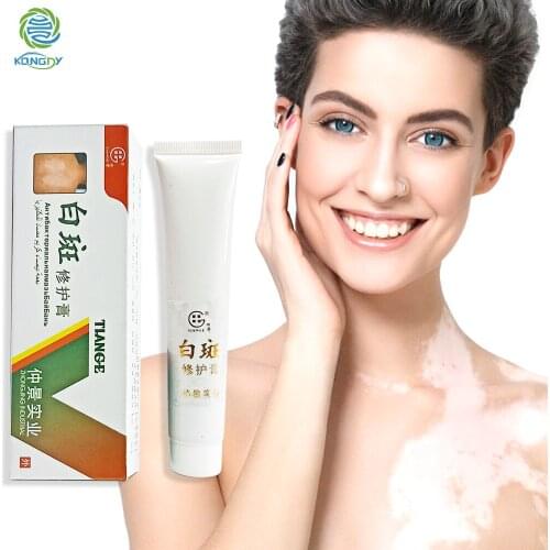 KONGDY White Spot Disease Treatment Ointment Vitiligo Leukoplakia Disease Repair Cream Chinese Cream