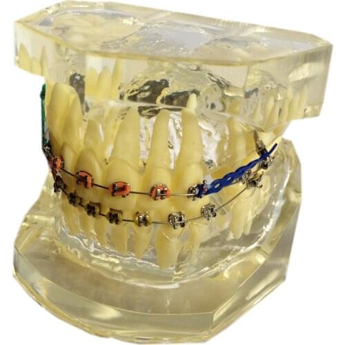 1 Pcs Dental Study Transparent Teeth Model Standard Orthodontic Model Brace Brackets Typodont