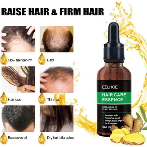 EELHOE 10/20/30/50ml Powerful Hair Loss Hair Treatment Ginger Hair Care Growth Essence Oil Hair Oil Hair Care TSLM2