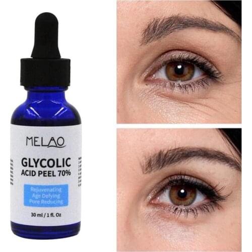 30ml Glycolic Acid Peel Balance Water And Oil Shrink Pores Brighten Skin Color Improve Acne Skin Nourishing Repair Solution