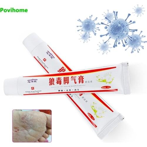 2pcs Beriberi Removal Cream Natural Chinese Medicine Anti Bacteria Ointment for Athlete Foot Erosion Peeling Blisters Feet Care