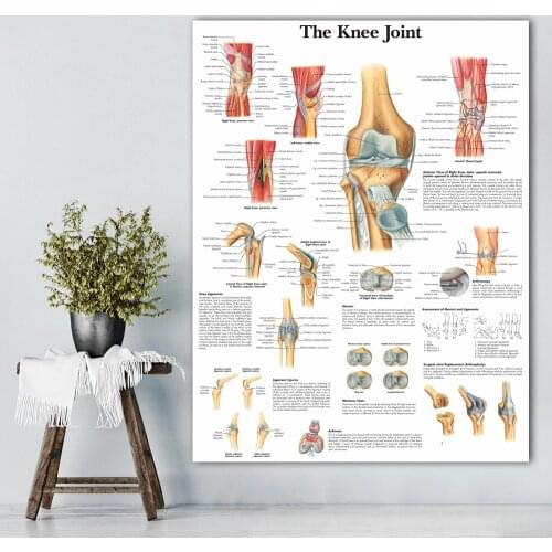 Print Canvas Home Knee Joint Decor Wall Art Anatomy Painting Modular Poster Medical Education Modern Picture For Doctor Office