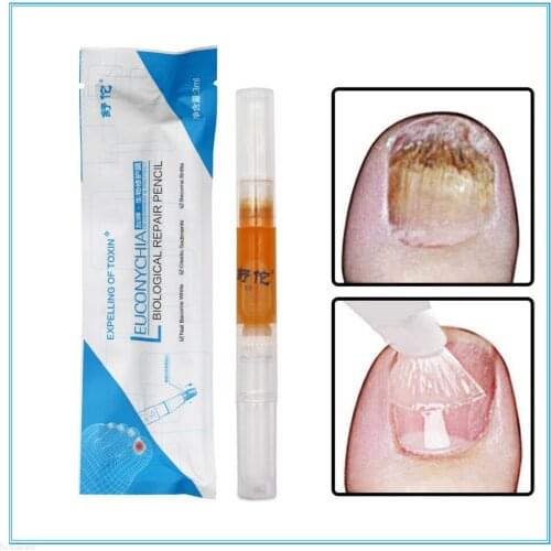 Advanced Fungal Nail Natural Repair Magic Pen
