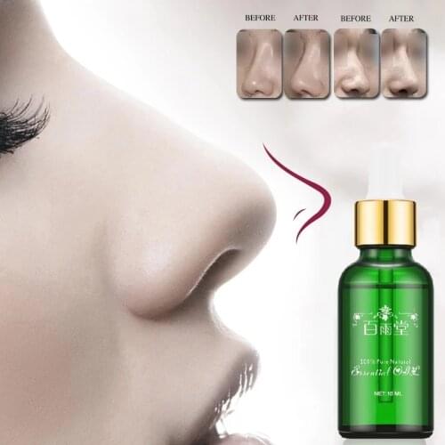 Nose Up Heighten Rhinoplasty Essential Oil 30ml Nasal Bone Rmodeling Pure Natural Nose Care Thin Smaller Nose 100% Effective