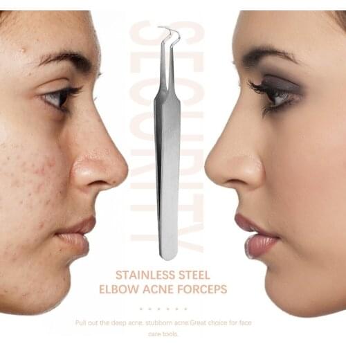 Acne Tweezers Black Head Pimples Removal Pointed Bend Gib Head Face Care Tools Blackhead Comedone Acne Extractor