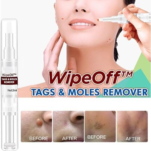 Clear Moles & Tag Wiper Beauty To Wart Pen 3ML