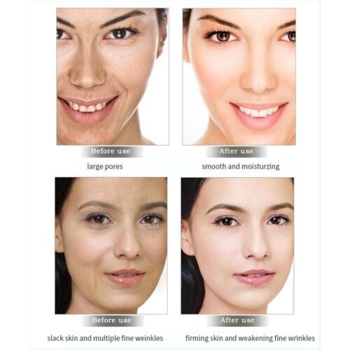 Moisturizer Face Cream Hyaluronic Acid Skin Whitening Moisturizing Aging Hydrating Anti Cream Cream Aloe Serum Anti Z8B5