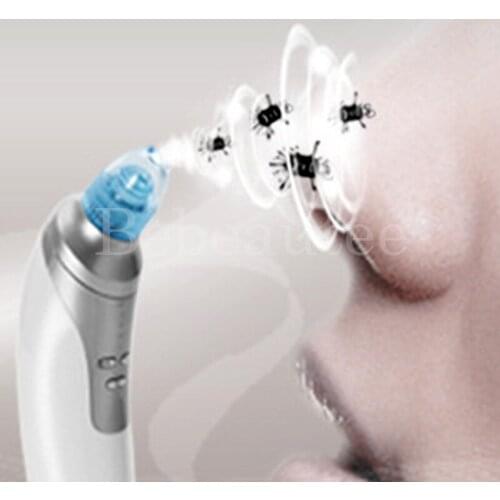 Vacuum Cleaner for Face Extrusion of Acne Sucker Clove Against Black Dots Anti Blackheads Remover Extractor of Pimples Extractor