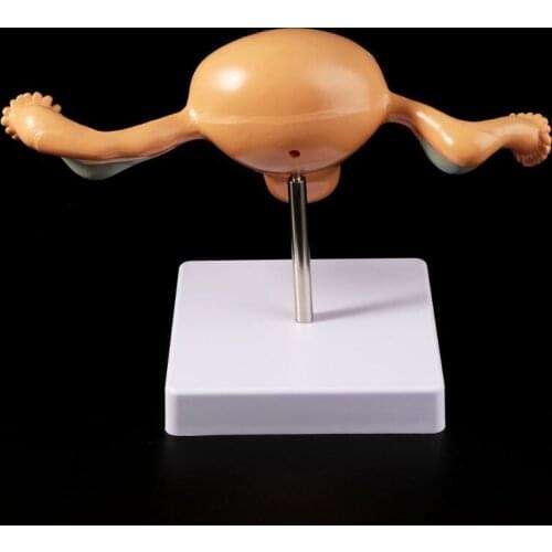 Human Pathological Uterus Ovary Model Anatomical Anatomy Disease Pathology Lesion For Teaching M5TE