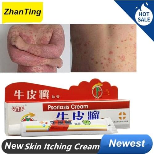 ZhanTing High Quality Psoriasis Cream Ointment Body Massage Patches Psoriasis Cream