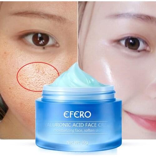 EFERO Hyaluronic Acid Face Cream Whitening Cream Moisturizer Anti Wrinkle Cream Face Care Skin Serum Anti Aging Face Creams 30g