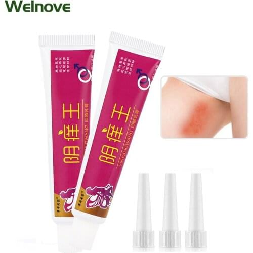 15g Pruritus Dermatitis Eczema Herbal Ointment Female Antibacterial Cream Anti Fungal Infect Cream Relief Itching Private Care