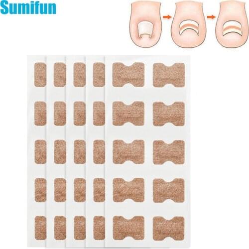 10/30/50pcs Foot Nail Correction Paste Pedicure Ingrown Toenail Correction Tool Inflammatory Thumb Roll Nail Correction Patch