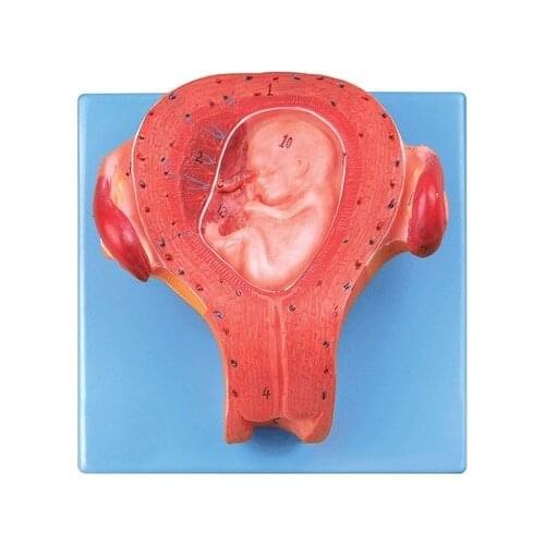 Three-month embryo model Medical teaching demonstration simulation model Embryonic development process model natural size