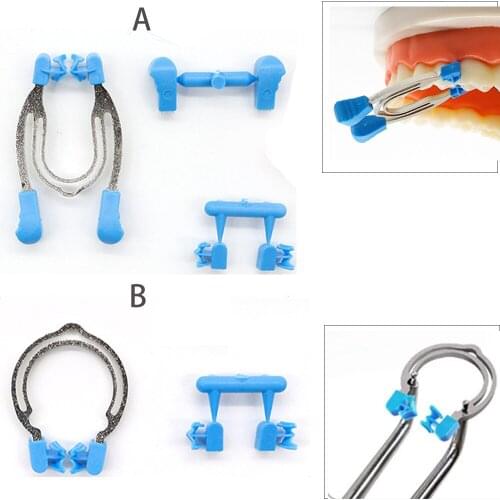 Dental Matrix Ring Sectional Contoured Metal Spring Clip Teeth Replacement Dentist Matrix Ring Dentist Instrument Tools