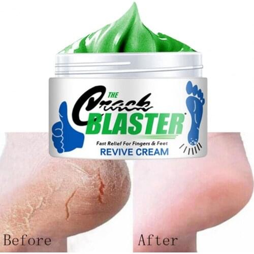 15g/ 30g/ 50g Cracked Heel Repair Cream Deeply Moisturize Soften Skin Dry Feet Treatment Rough Dry Feet Repair Cream for Repair