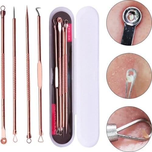 4PCS Rose Gold Stainless Steel Extractor Blackhead Remover Needles Acne Pimple Blemish Treatments Face Skin Care Beauty Tools