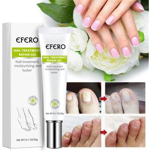 Toe Be Health Instant Beauty Gel Hydration Nail Fungal Infection Treatment Cream