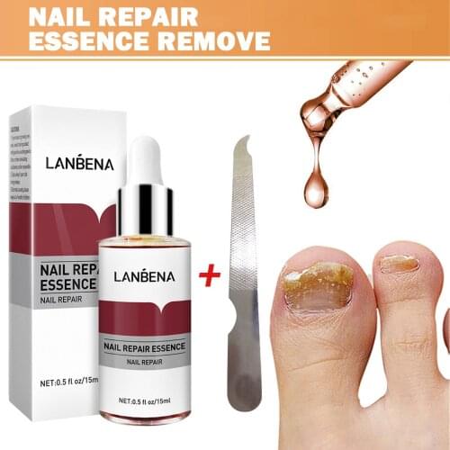 LANBENA Nail Repair Essence Serum Anti Fungal Repair Removal Infection Paronychia Onychomycosis Treatment Hand Foot Toe Care