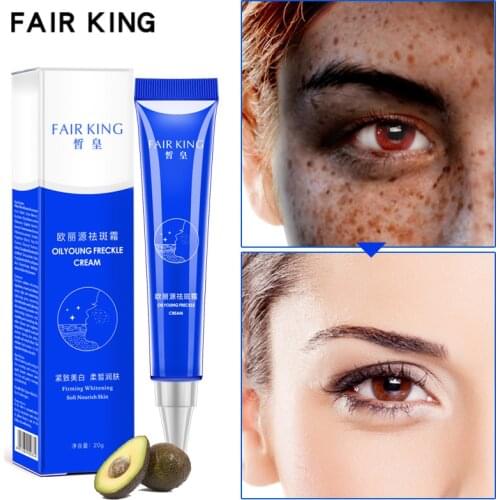 New 2021 Strong Effects Powerful Whitening Freckle Cream 20g Remove Melasma Acne Spots Pigment Melanin Face Care Cream