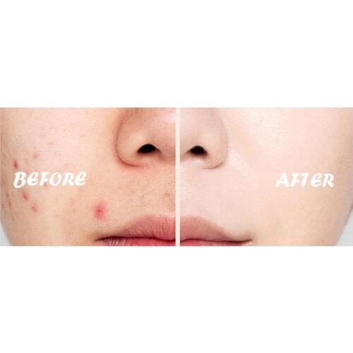 2.7g Natural Color Face Concealer Cover Dark Circles Cosmetics Base Foundation Cream Liquid Concealer Face Makeup Tools