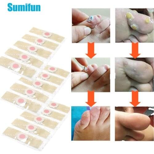 18pcs Foot Corn Removal Pads Toe Protector Medical Plaster Warts Thorn Killer Pain Relief Sticker Calluses Patch Foot Care Tool